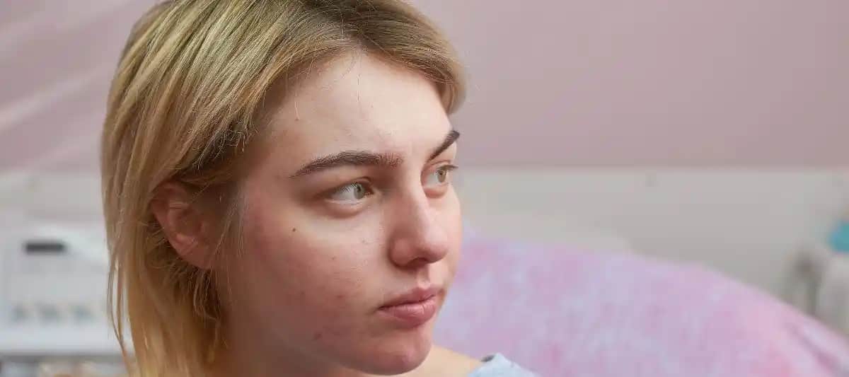 Yıllarca Süregelen Sivilceler İçin Etkili Çözüm ve Bakım Yöntemleri