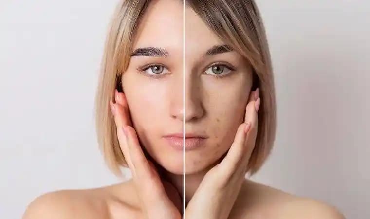 Yıpranmış Cilt Nasıl Onarılır ve Sağlıklı Görünüm Kazanır