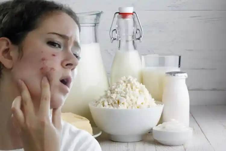 Yulaf ve Sivilce İlişkisi: Doğal Güzellik İçin Etkili Çözüm Yolları