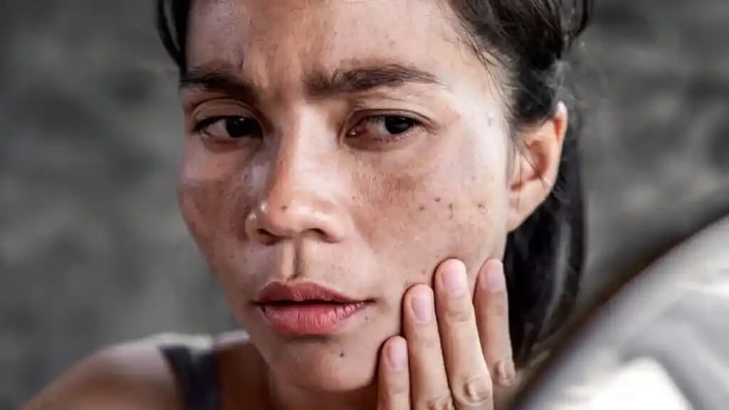 Yüz Kararmasının Nedenleri ve Etkili Korunma Yöntemleri Hakkında Detaylı Bilgi