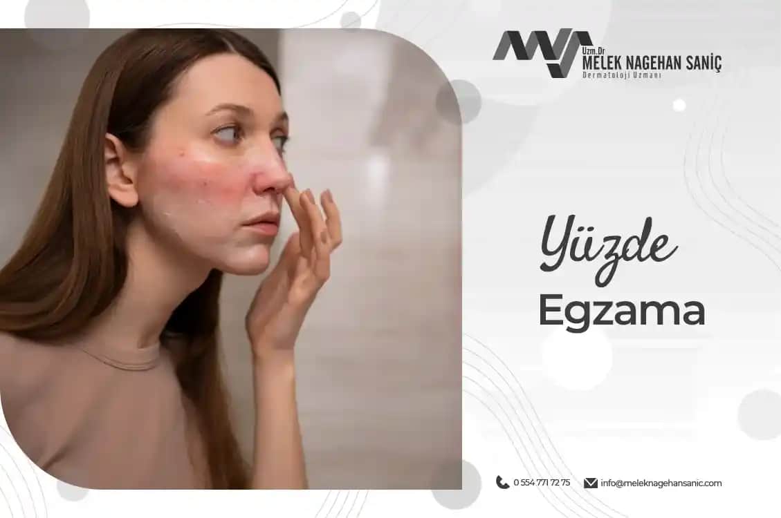 Yüz Kuru Egzama Nedir, Belirtileri ve Etkili Cilt Bakım Yöntemleri