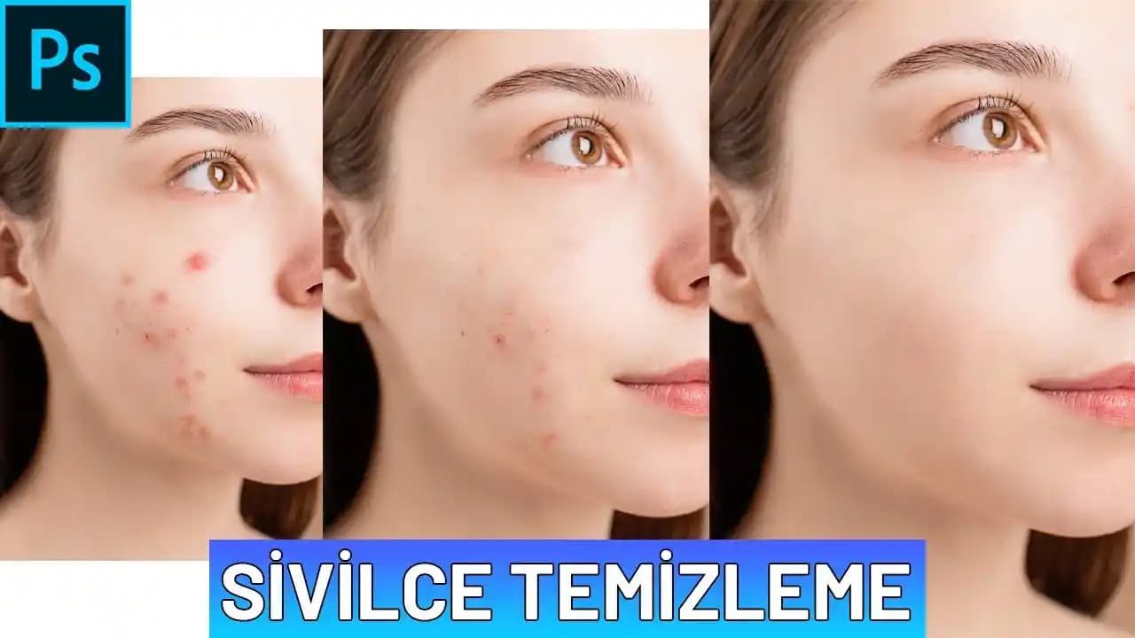 Yüz Pürüzsüzleştirme Yöntemleri ve Günlük Bakım İpuçları