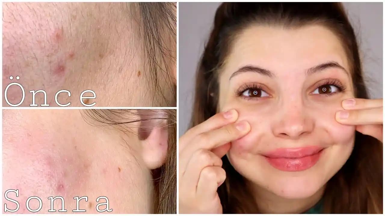 Yüz Tüylerini Sarartma: Güvenli ve Modern Güzellik Trendleri Hakkında Bilmeniz Gerekenler