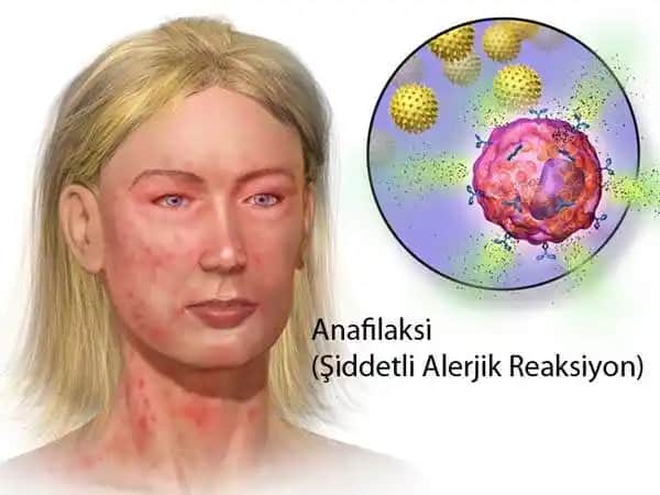 Yüzde Alerjik Reaksiyonları: Nedenleri, Belirtileri ve Korunma Yöntemleri