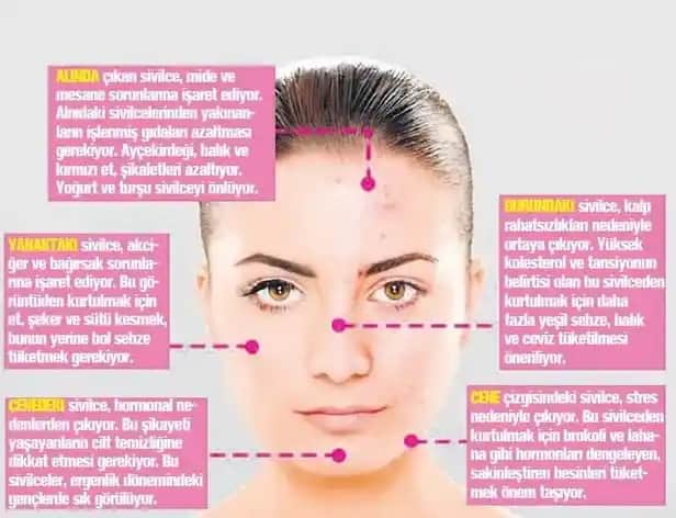 Yüzde Aniden Çıkan Sivilceler: Nedenleri ve Etkili Çözüm Yolları