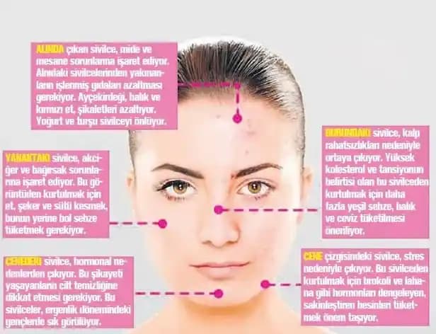 Yüzde Aniden Çıkan Sivilceler: Nedenleri ve Etkili Çözüm Yolları