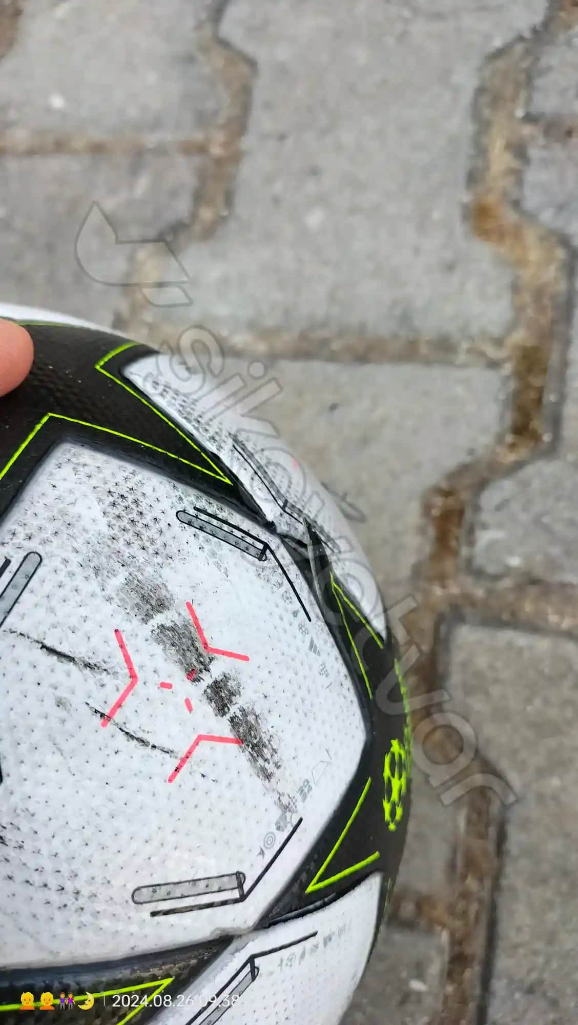 Yüzde Kabuk Atması Nedenleri, Bakımı ve Önleyici Tedbirler Hakkında Detaylı Bilgi