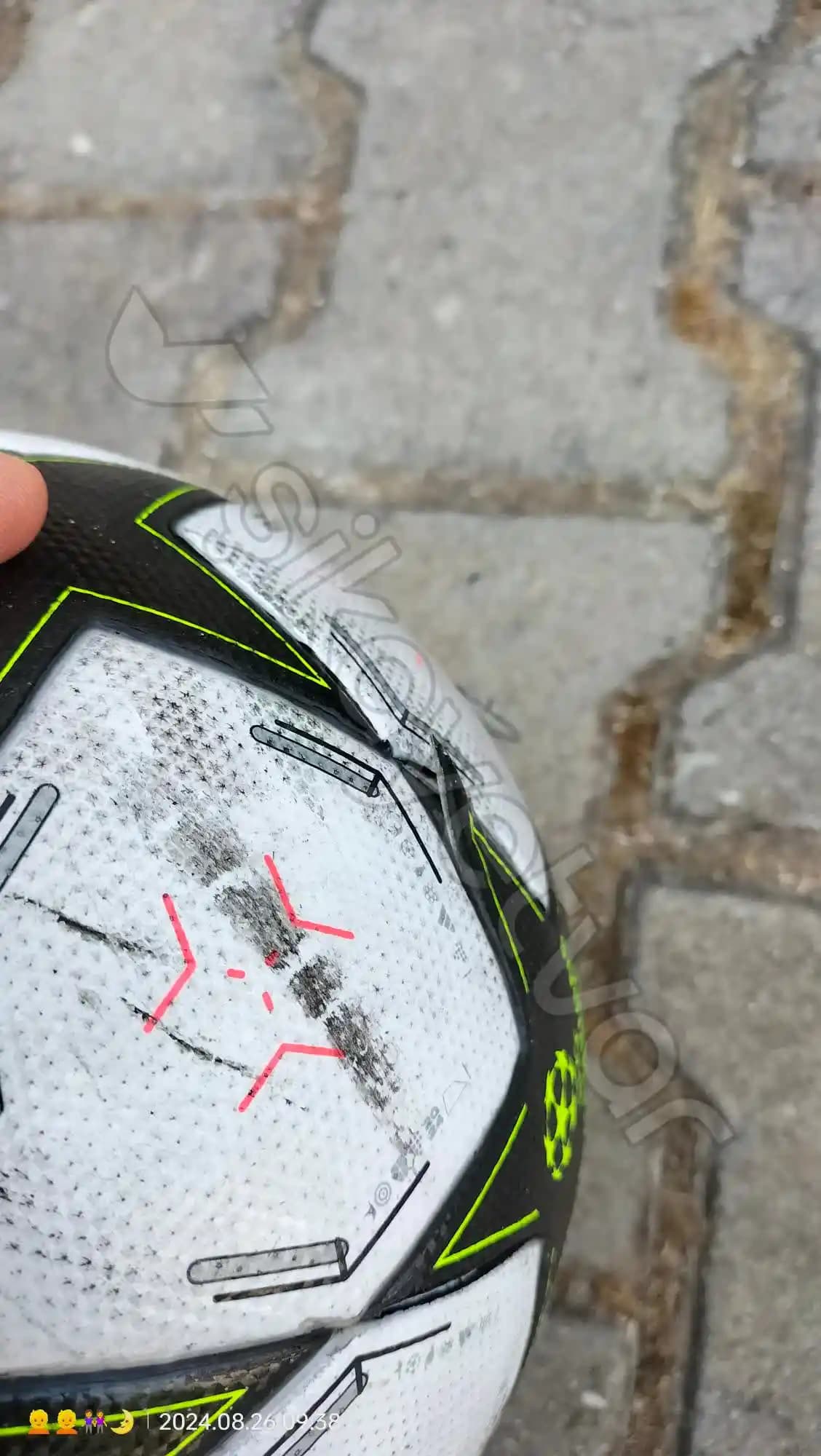 Yüzde Kabuk Atması Nedenleri, Bakımı ve Önleyici Tedbirler Hakkında Detaylı Bilgi