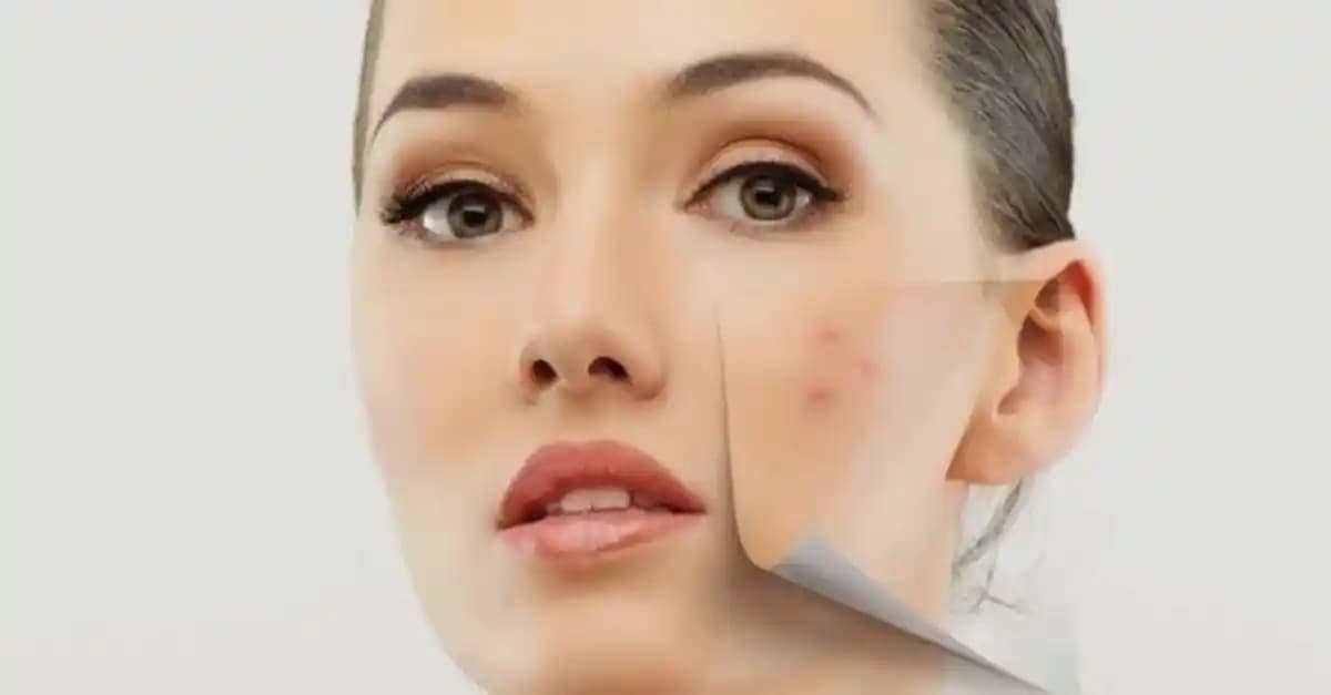 Yüzde Yara Nedenleri ve Alınabilecek Önlemler: Cilt Sağlığını Koruma Yöntemleri