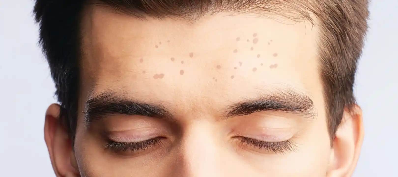 Yüzdeki Çil Nasıl Giderilir? Etkili Yöntemler ve Cilt Bakım İpuçları