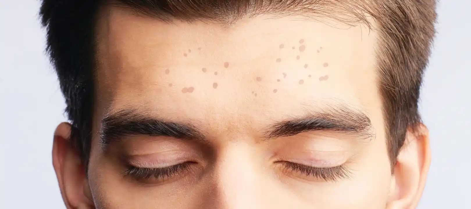 Yüzdeki Çil Nasıl Giderilir? Etkili Yöntemler ve Cilt Bakım İpuçları