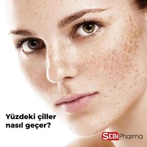 Yüzdeki Çiller: Doğal Güzellik ve Bakım Yöntemleri Hakkında Bilmeniz Gerekenler
