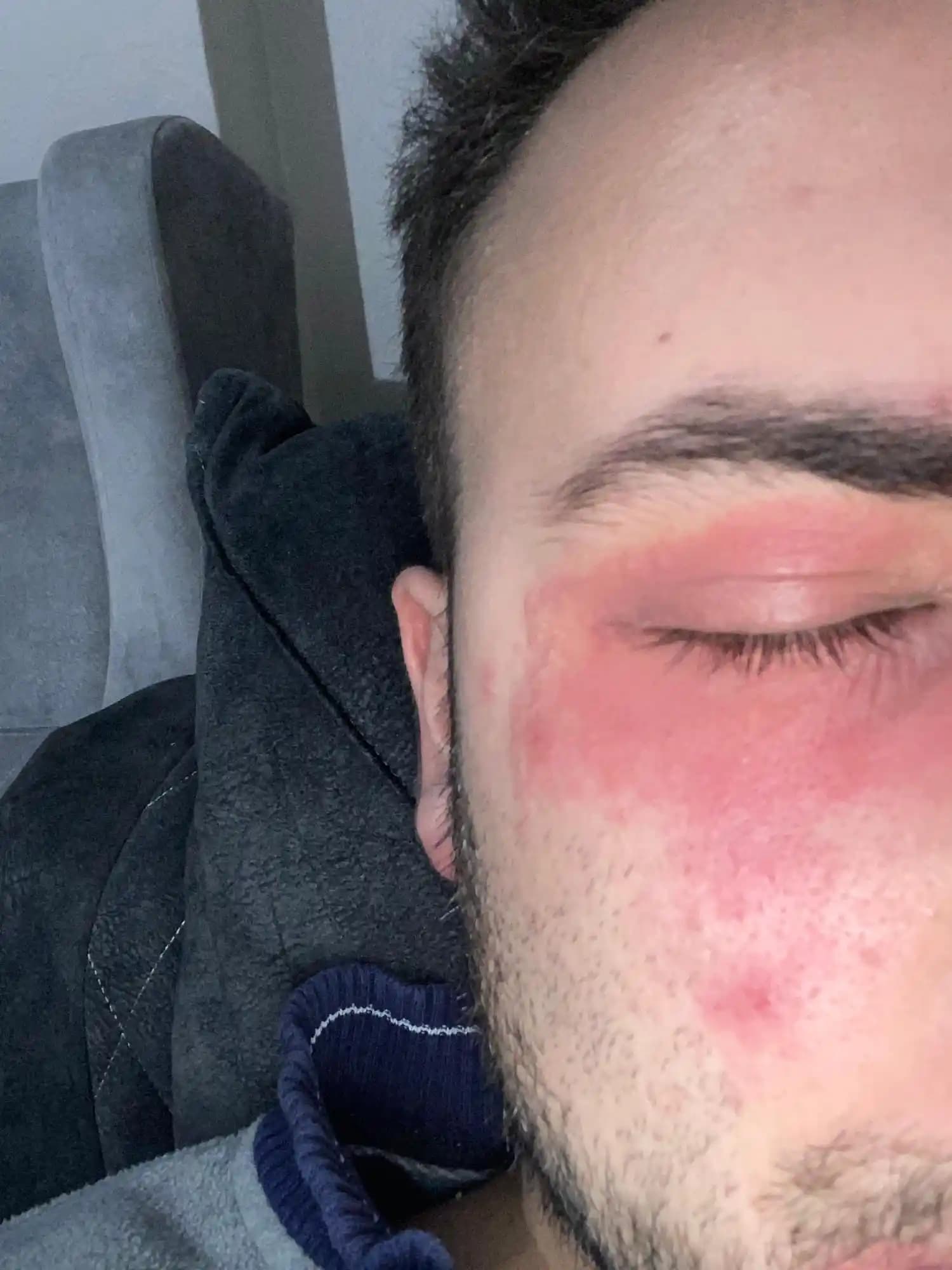 Yüzdeki Kaşıntı ve Yanma Sorunları: Kozmetik Ürünlerle İlgili Bilinçli Yaklaşımlar ve Doğru Bakım Yöntemleri