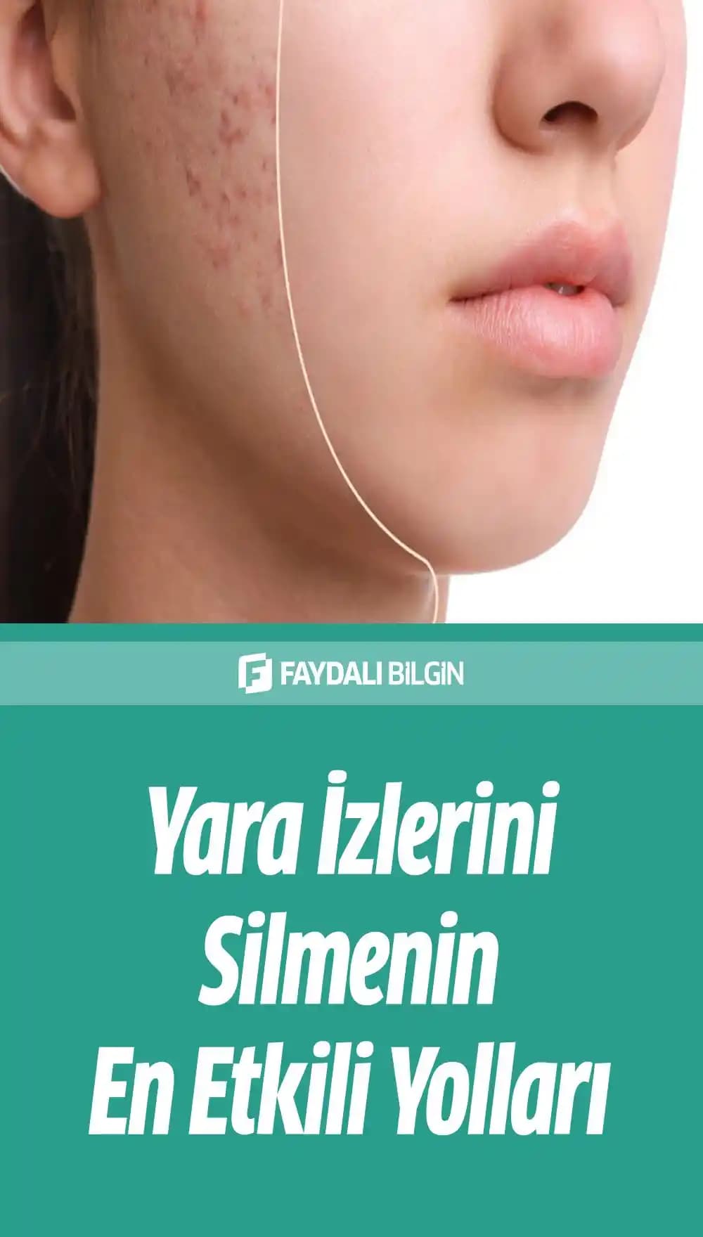 Yüzdeki Kesik İzleri Nasıl Geçer: Etkili Tedavi Yöntemleri ve Tavsiyeler
