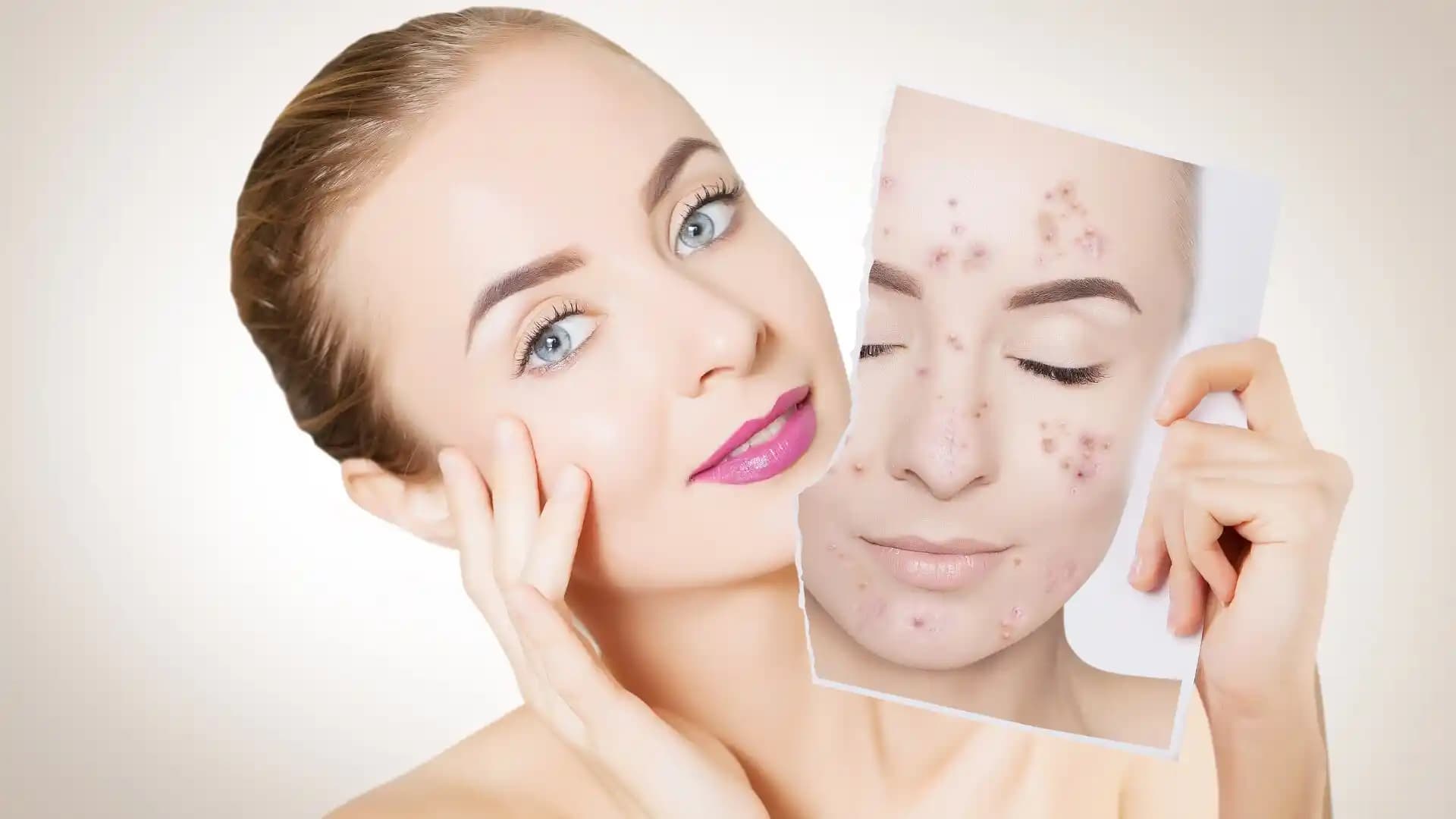 Yüzdeki Komedonlar Nasıl Giderilir ve Önlenir Detaylı Cilt Bakımı Yöntemleri