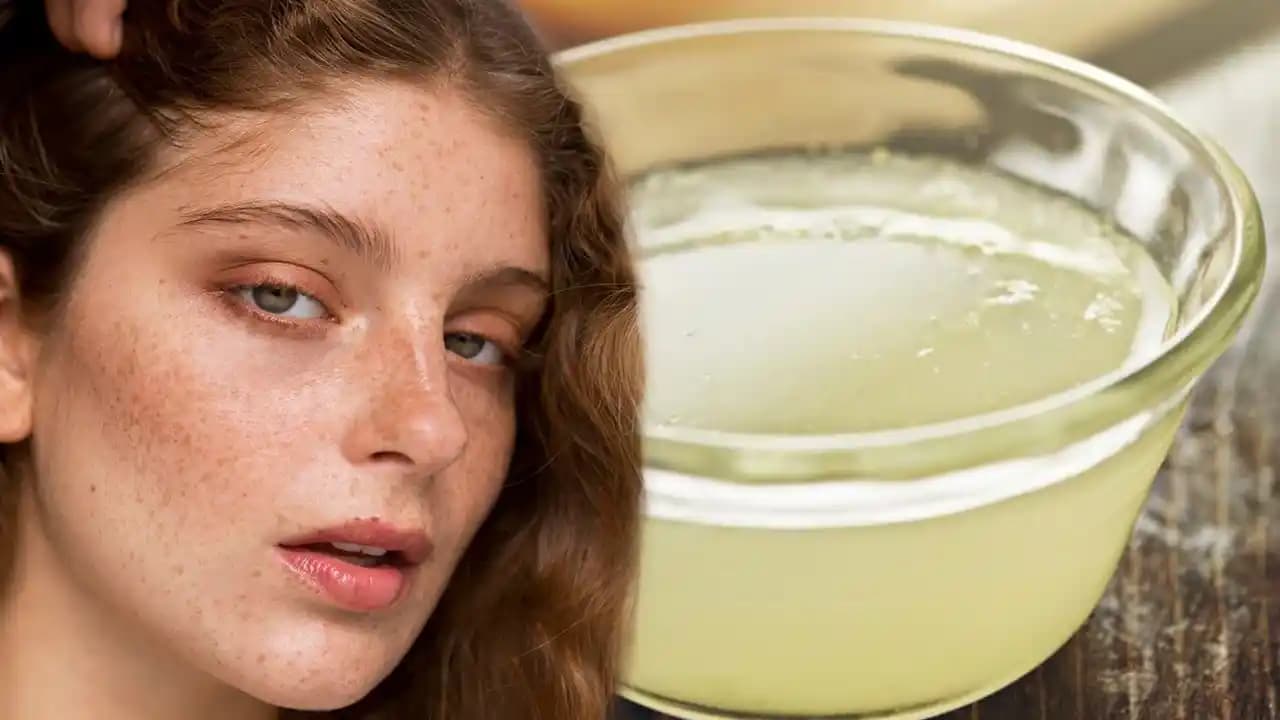 Yüzdeki Parlama ve Lekelerin Nedenleri ile Etkili Çözüm Yöntemleri