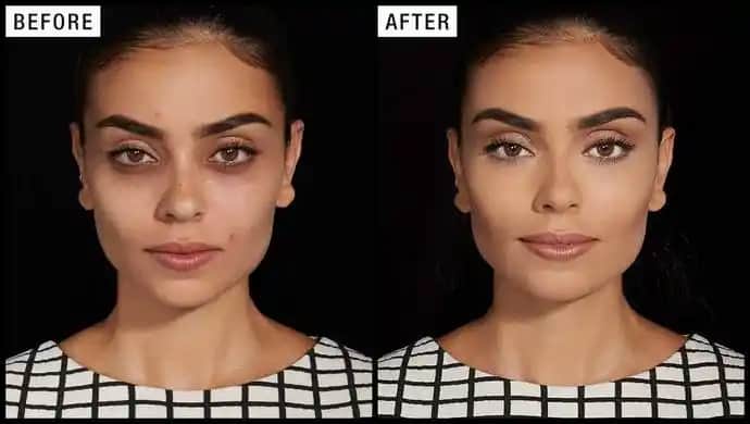 Yüzdeki Renk Eşitsizliği Nasıl Giderilir: Doğal ve Profesyonel Çözüm Yöntemleri