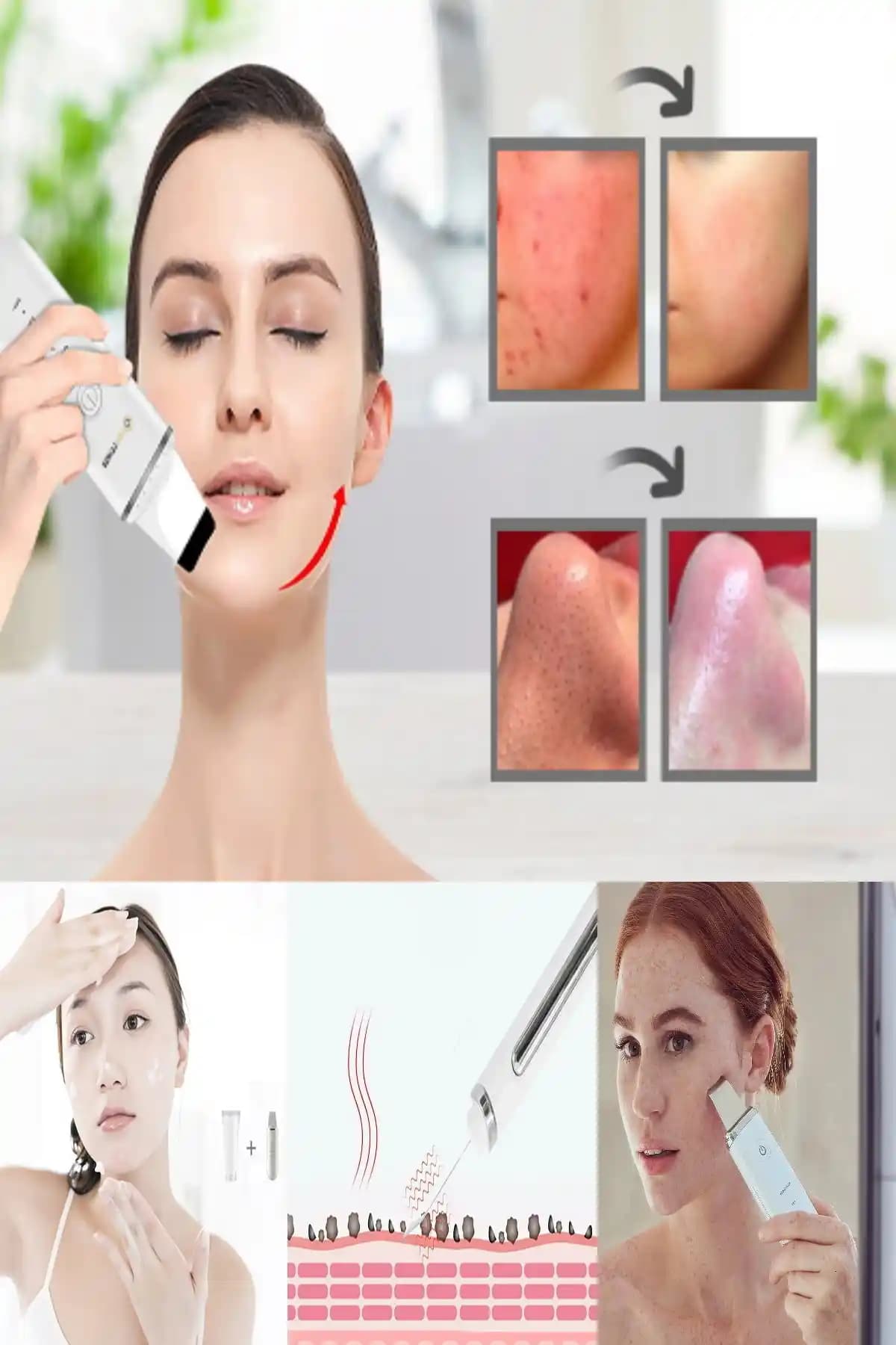 Yüzdeki Siyah Noktalarla Mücadele ve Temizleme Yöntemleri Hakkında Detaylı Bilgi