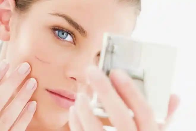 Yüzdeki Yara İzleri İçin Etkili Yöntemler ve Cilt Sağlığı Tavsiyeleri