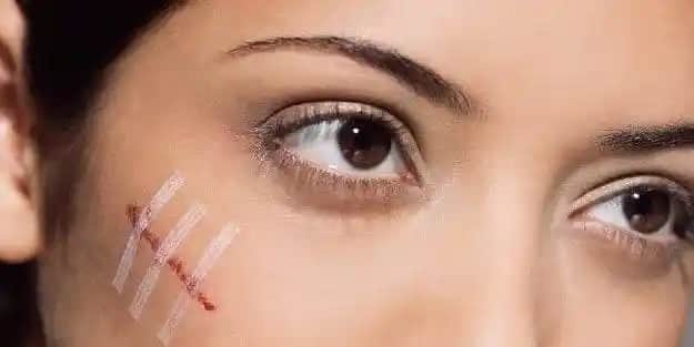 Yüzdeki Yara İzlerini Doğal Yollarla Hafifletme ve Cilt Sağlığını Destekleme