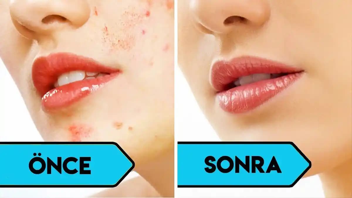 Yüzü Parlatan Kremler ve Doğal Yöntemlerle Parlak Cilt Sağlama Rehberi