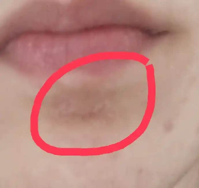 Yüzünüz Çok Kuru ve Pul Pul Dökülü İse Uygun Bakım Yöntemleri ve Çözüm Rehberi