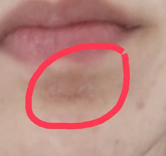 Yüzünüz Çok Kuru ve Pul Pul Dökülü İse Uygun Bakım Yöntemleri ve Çözüm Rehberi