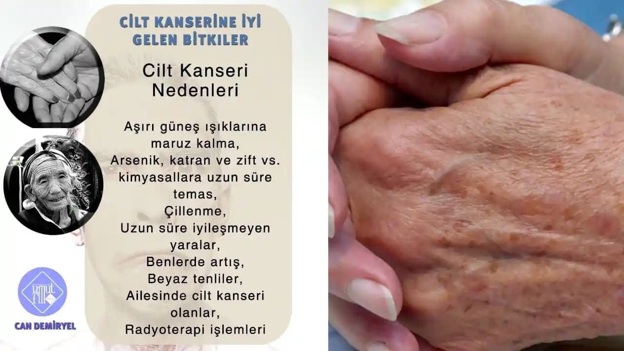 Cilt Kanserine Karşı Kozmetik ve Doğal Yöntemler: En Etkili Koruma Stratejileri