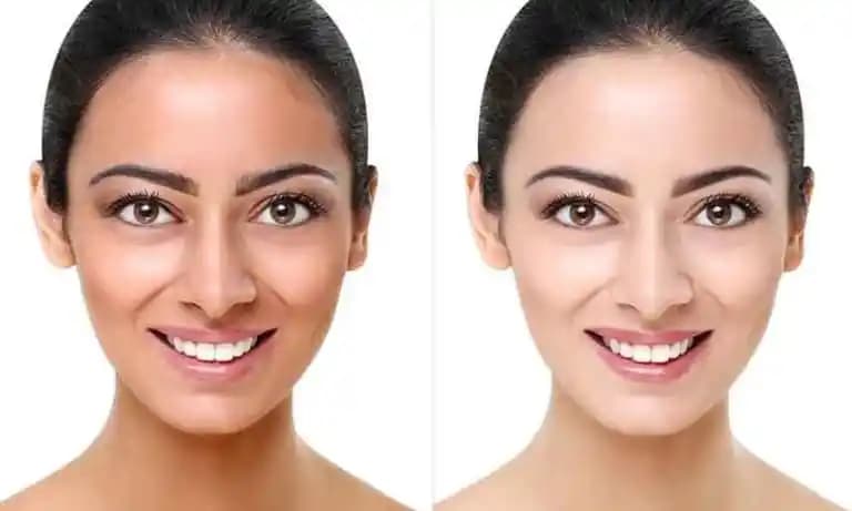 Cilt Rengini Güvenilir ve Kalıcı Yöntemlerle Açma Rehberi