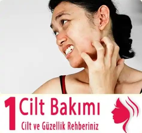 Cilt Tahrişini Hafifletmek ve Hızlı İyileşme İçin Doğal Yöntemler ve Bakım İpuçları