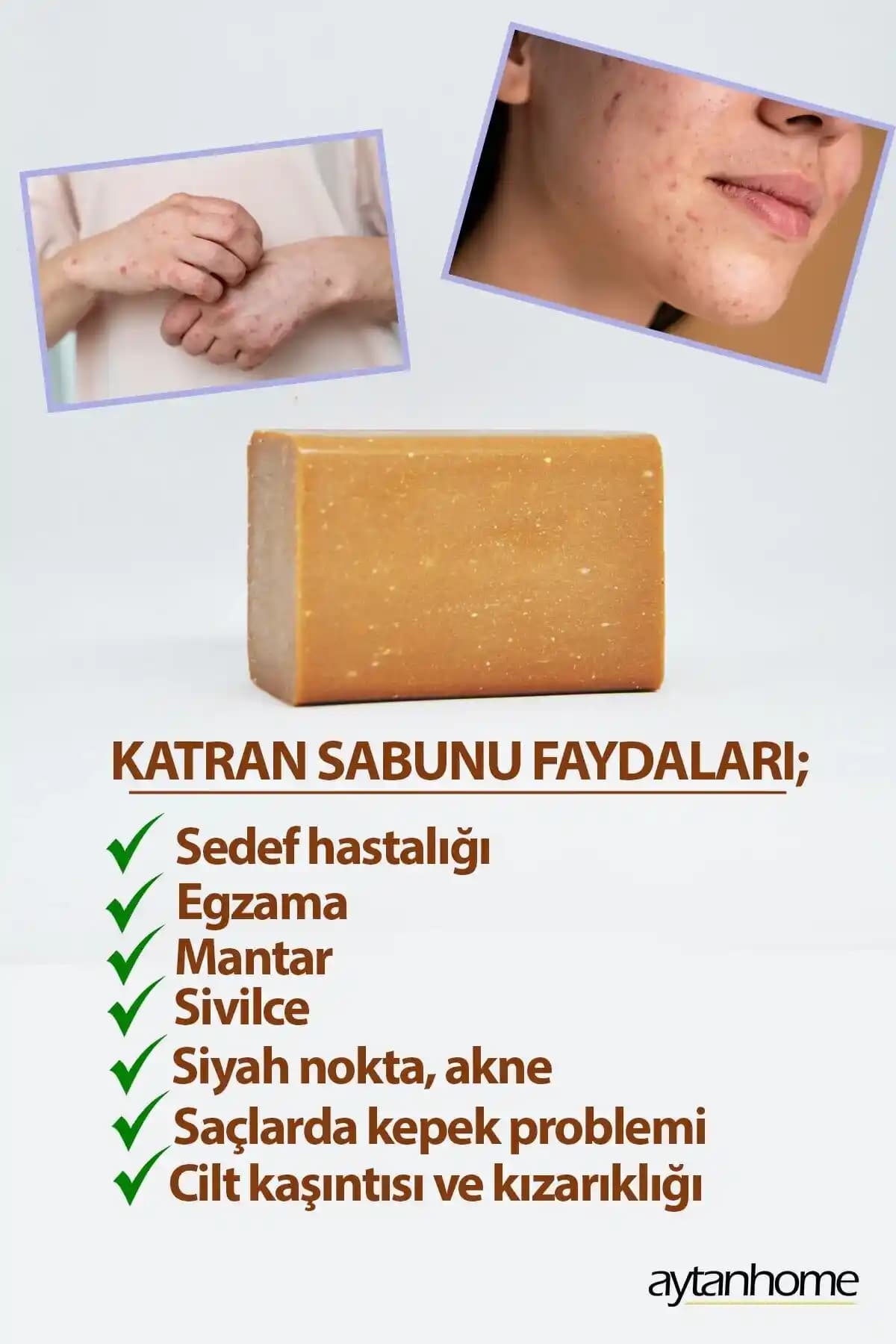 Egzama Sabunu Nedir Cilt Sağlığını Koruyan Doğru Seçenekler ve Kullanım İpuçları