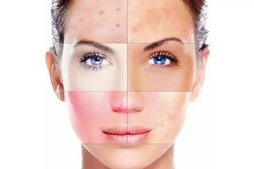 Karma Cilt Nedir? Dengeli ve Çok Yönlü Bir Cilt Tipi Hakkında Detaylar