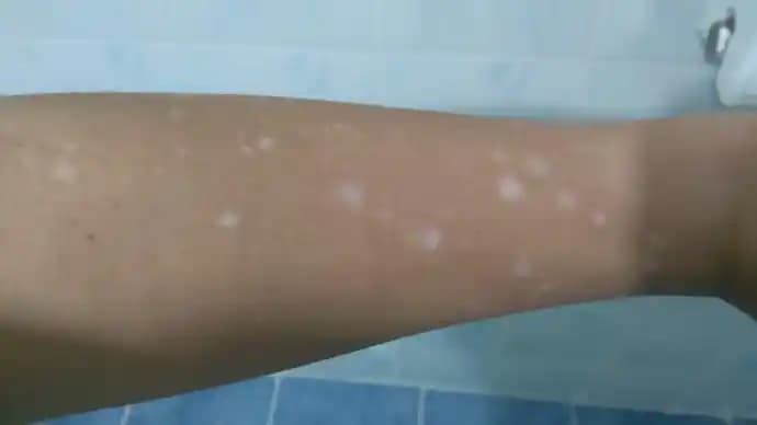 Kollardaki Lekelerin Nedenleri ve Etkili Giderme Yöntemleri Hakkında Kapsamlı Rehber