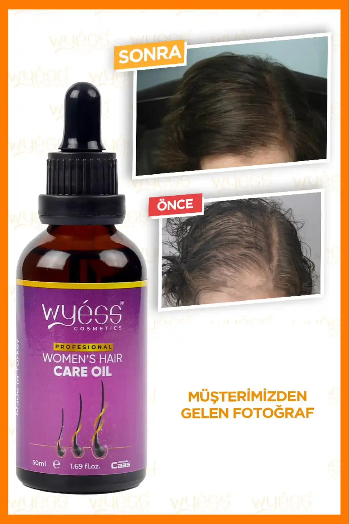 Saç Çıkaran Yağlar ve Saç Sağlığını Destekleyen Doğal Çözümler