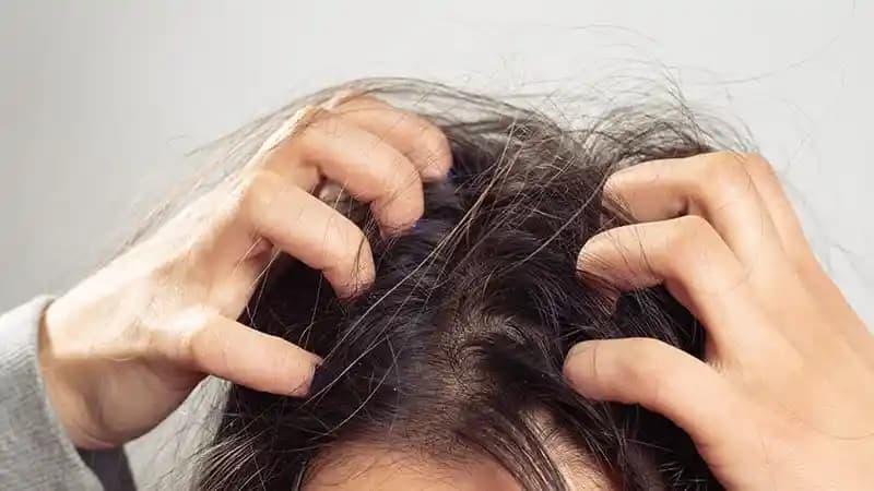 Saç Derisi Kaşıntısının Nedenleri ve Doğal Çözüm Yolları Hakkında Kapsamlı Bilgi