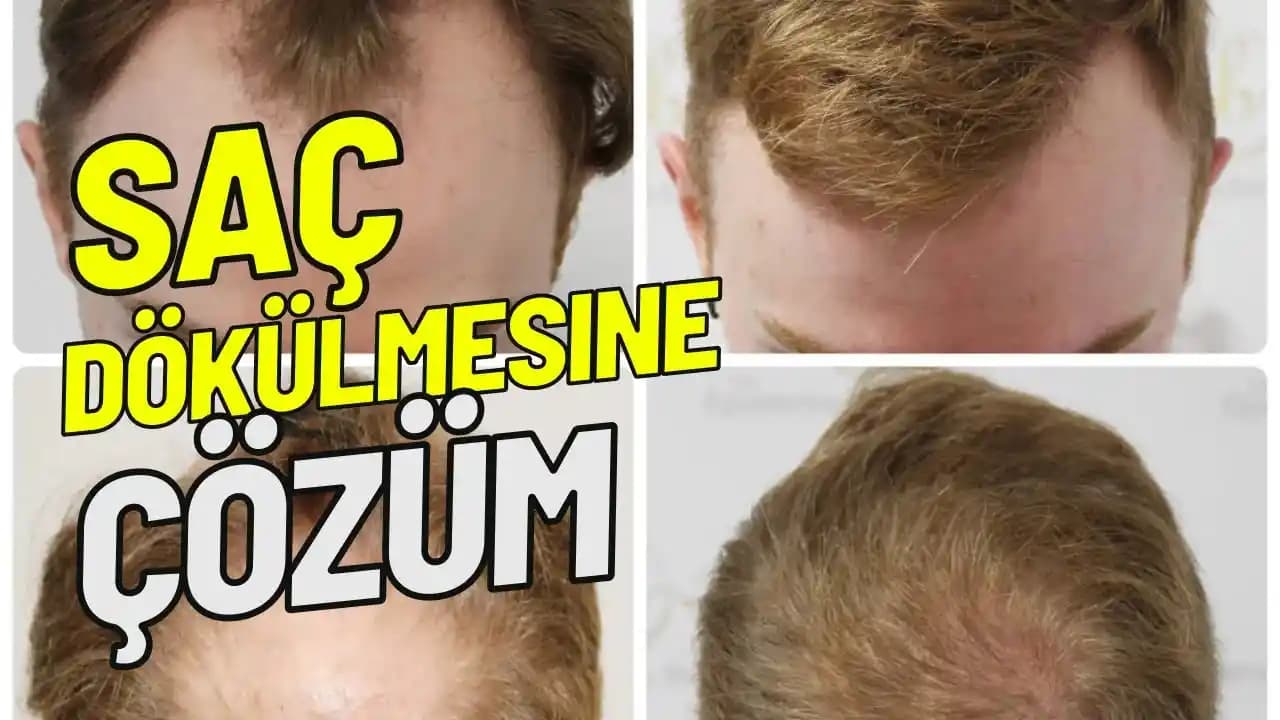 Saç Dökülmesine Karşı Etkili Doğal ve Kozmetik Çözüm Yöntemleri