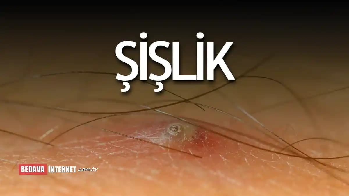 Sivilce Gibi Şişliklerin Nedenleri ve Etkili Çözüm Yolları