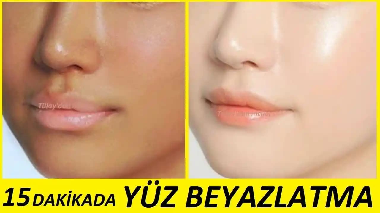 Yüz Beyazlatma Yöntemleri: Doğal ve Medikal Seçeneklerle Sağlıklı Cilt İpuçları