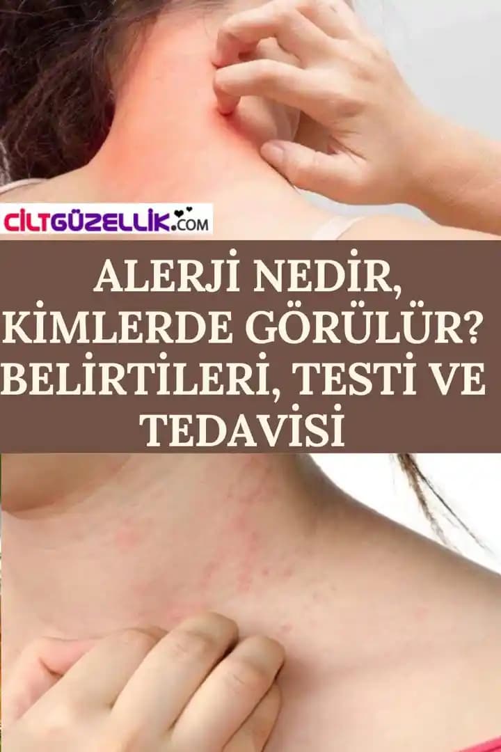 Yüzde Alerji Nedenleri ve Korunma Yolları Hakkında Detaylı Bilgi