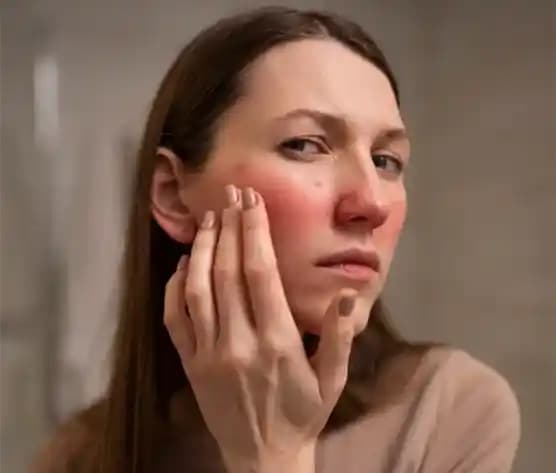 Yüzde Egzama Nedenleri ve Korunma Yolları: Cilt Sağlığınızı Koruma Rehberi