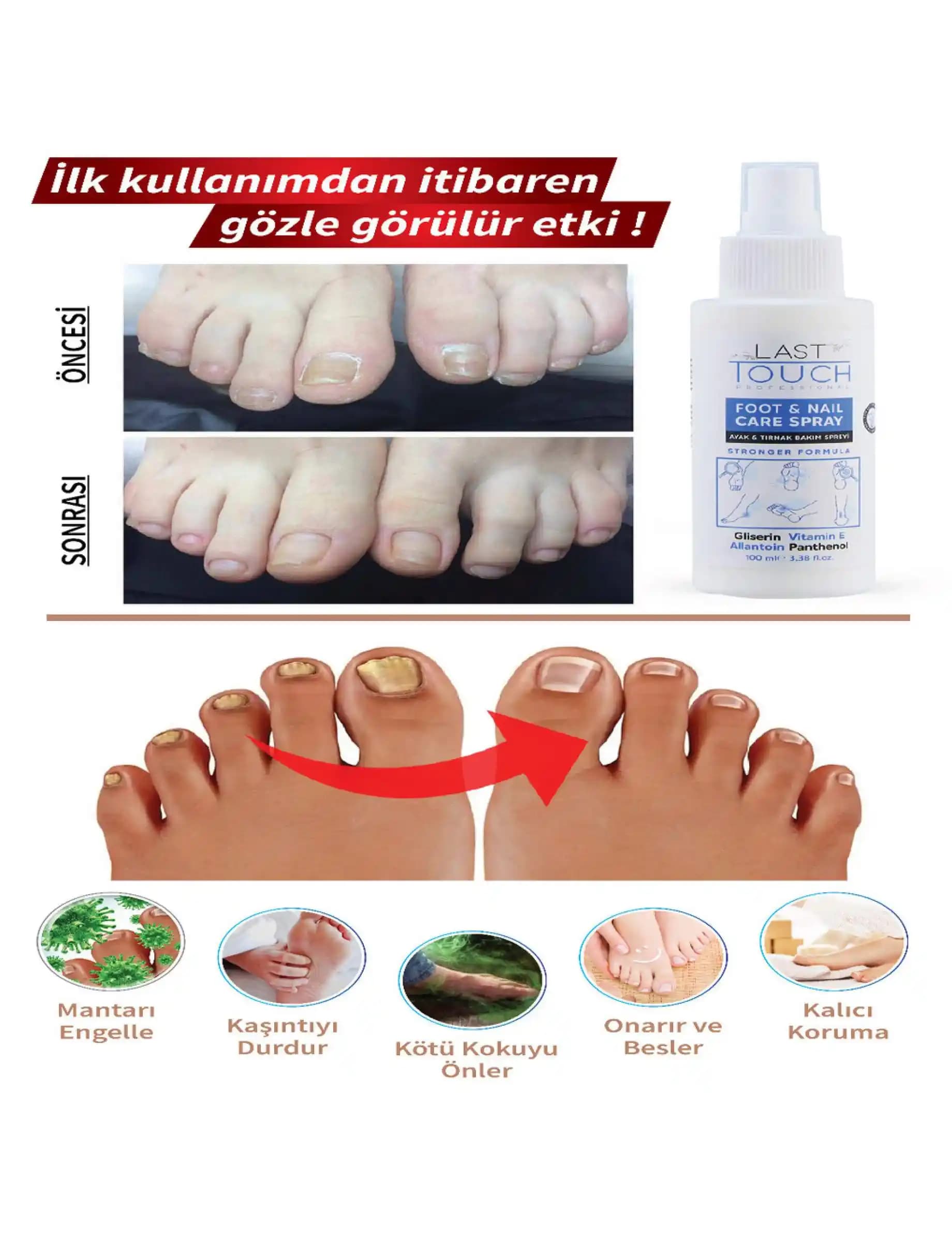 Ayak Mantarına Karşı En Etkili Tedavi Yöntemleri ve Doğru İlaç Seçimi Rehberi