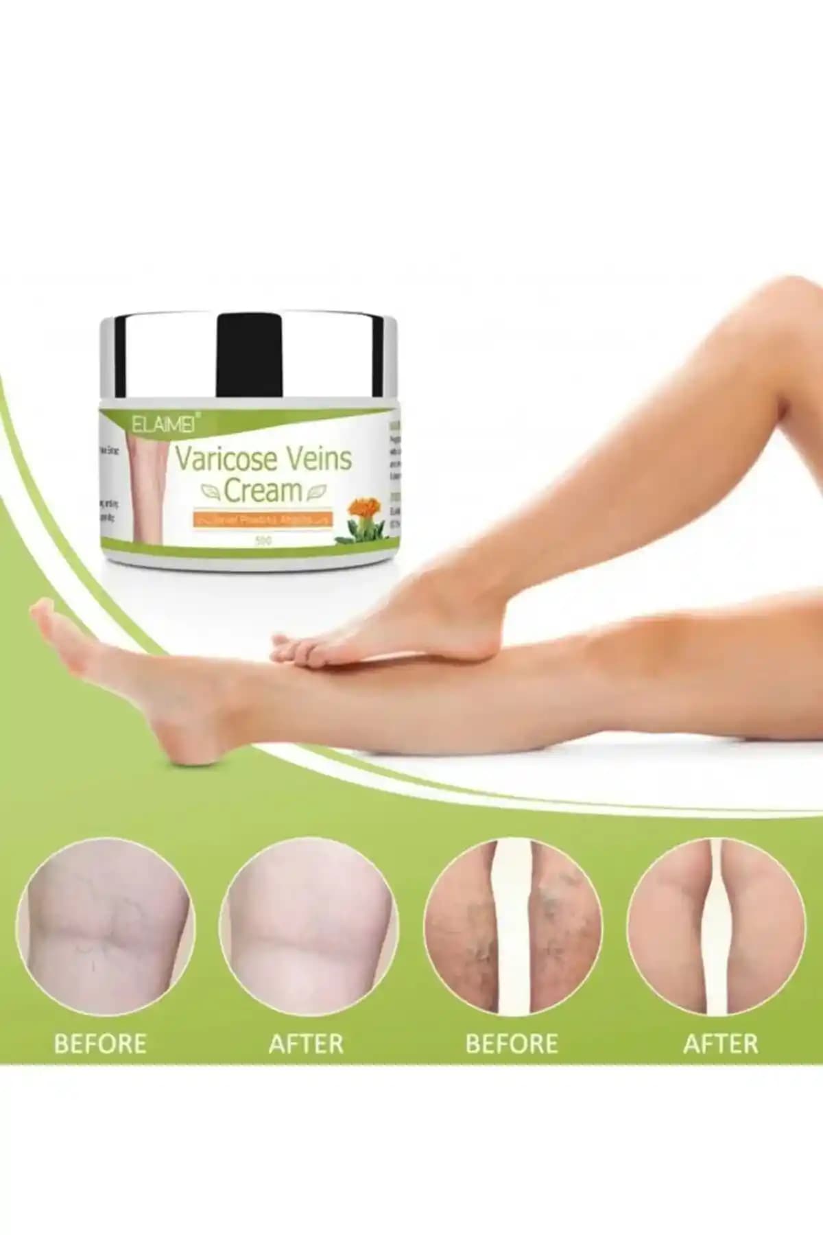 Bacak Varisleri İçin Kozmetik Çözümler ve Etkili Kullanım Yöntemleri