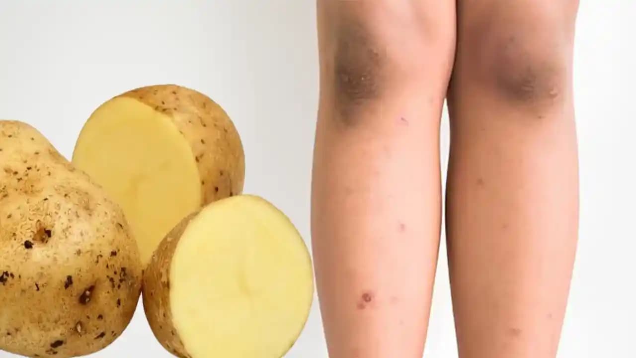 Bacaklardaki Lekeleri Azaltmak İçin Etkili Yöntemler ve Cilt Bakım İpuçları