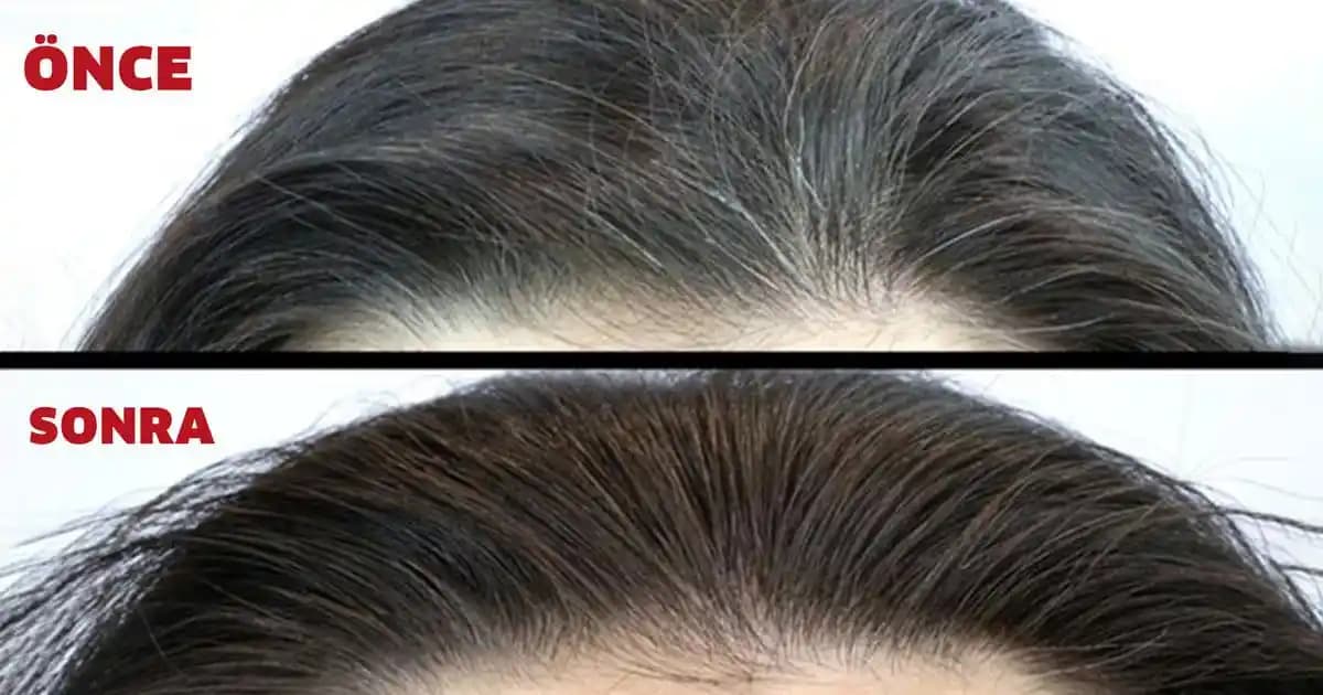 Beyaz Saçlarla Başa Çıkmak İçin Doğal ve Kozmetik Yöntemler ve Yaşam Tarzı İpuçları