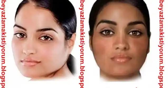 Cilt Beyazlatma Yöntemleri ve Doğal Çözümler Hakkında Kapsamlı Bilgiler