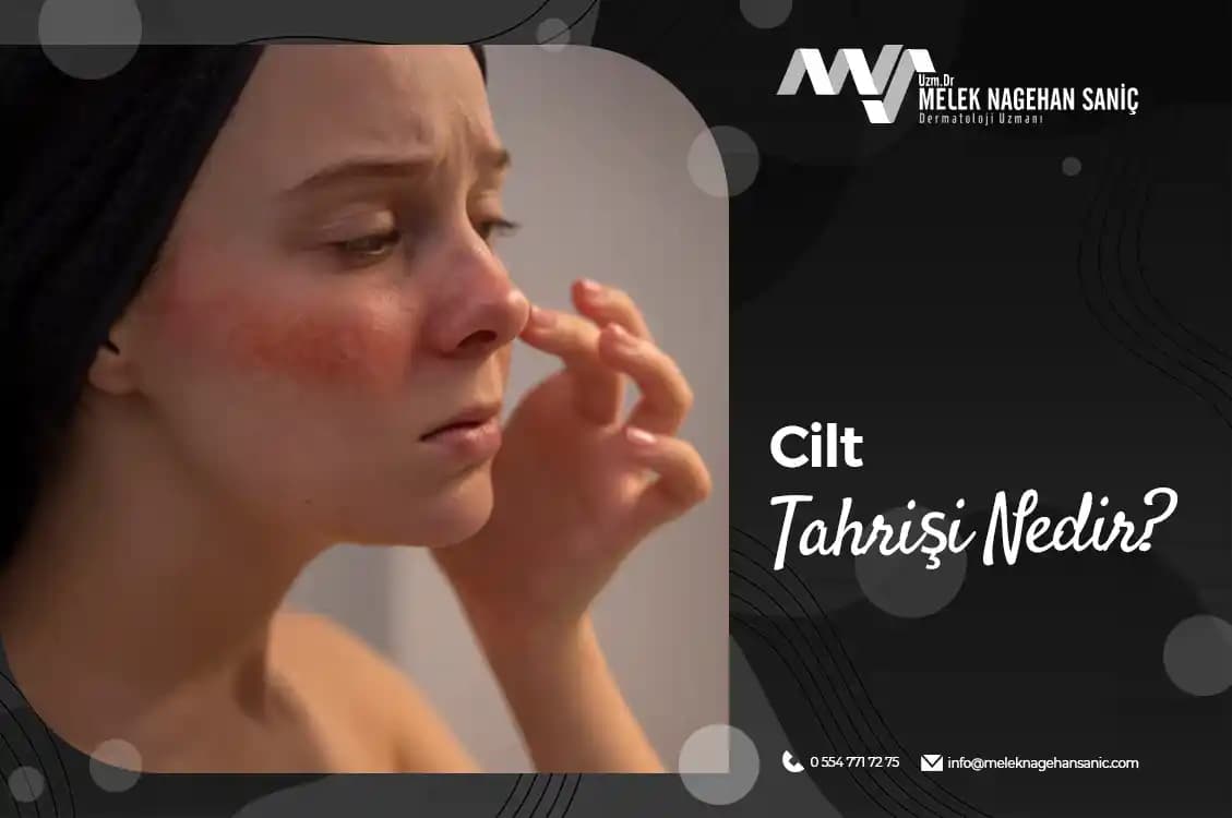 Cilt Tahrişine Karşı Doğru Bakım Yöntemleri ve Tavsiyeler