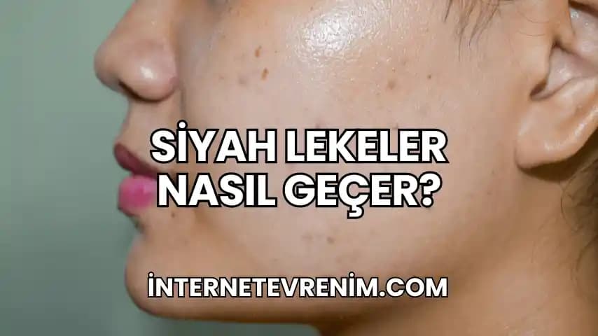 Derideki Siyah Lekelerin Nedenleri, Tedavi Yöntemleri ve Bakım İpuçları