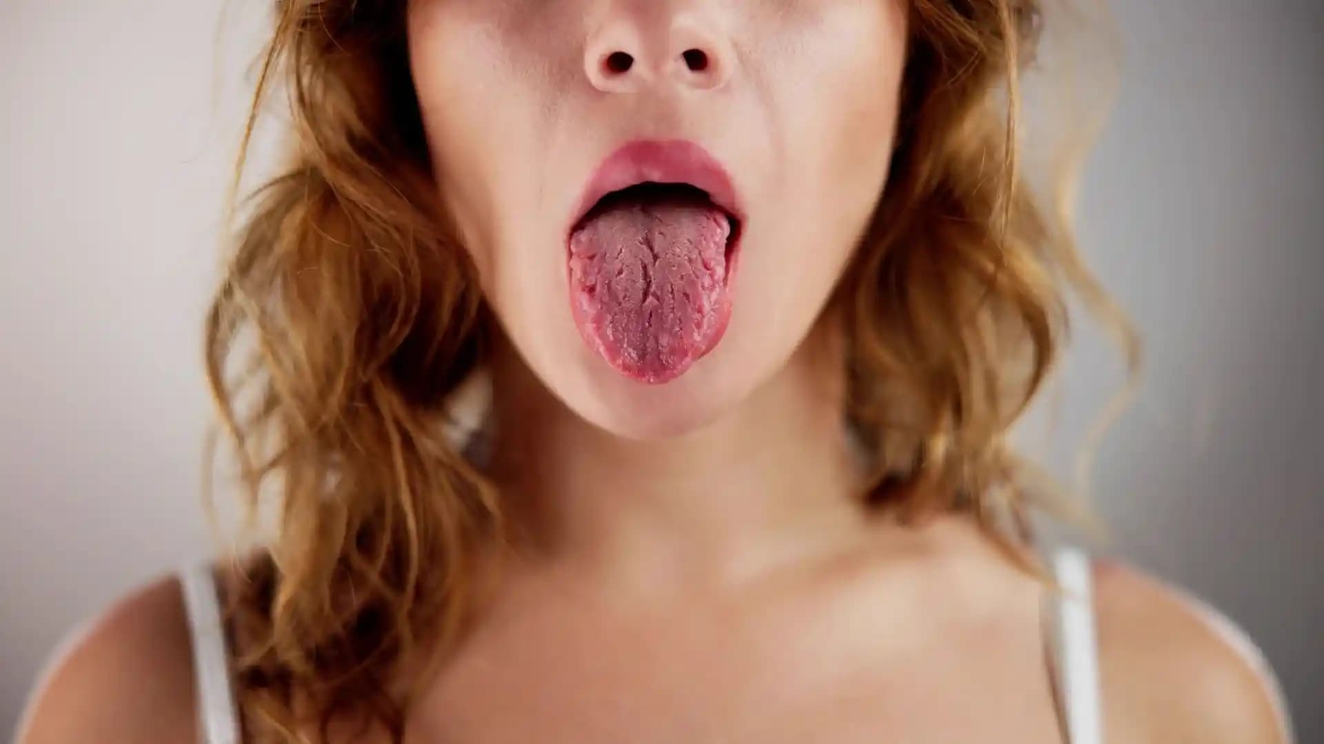 Dudak Çatlaklarına Karşı Etkili Kozmetik Yaklaşımlar ve Sağlıklı Dudaklar İçin İpuçları