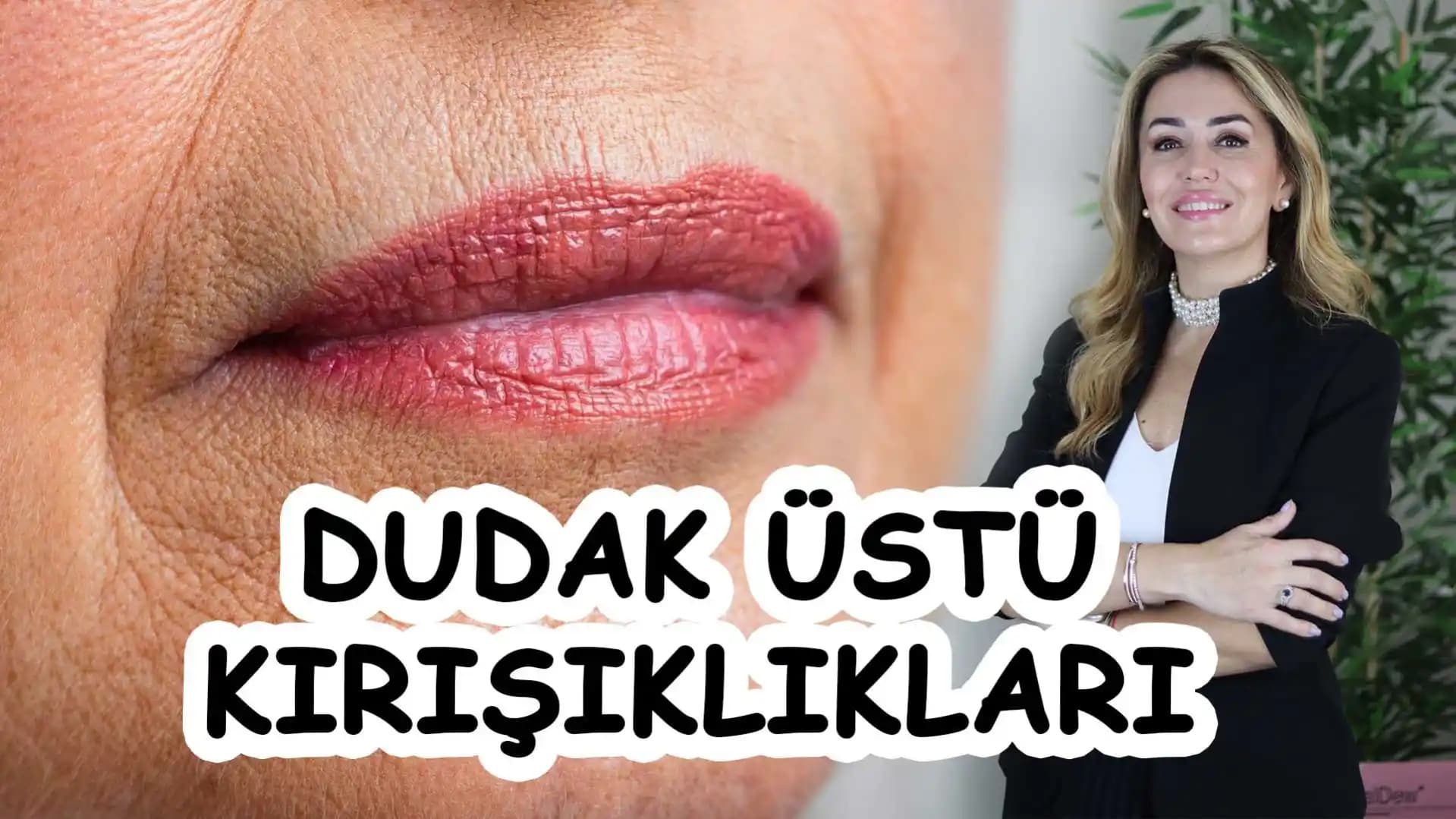 Dudak Üstü Kızarıklığının Nedenleri, Belirtileri ve Etkili Çözüm Yolları