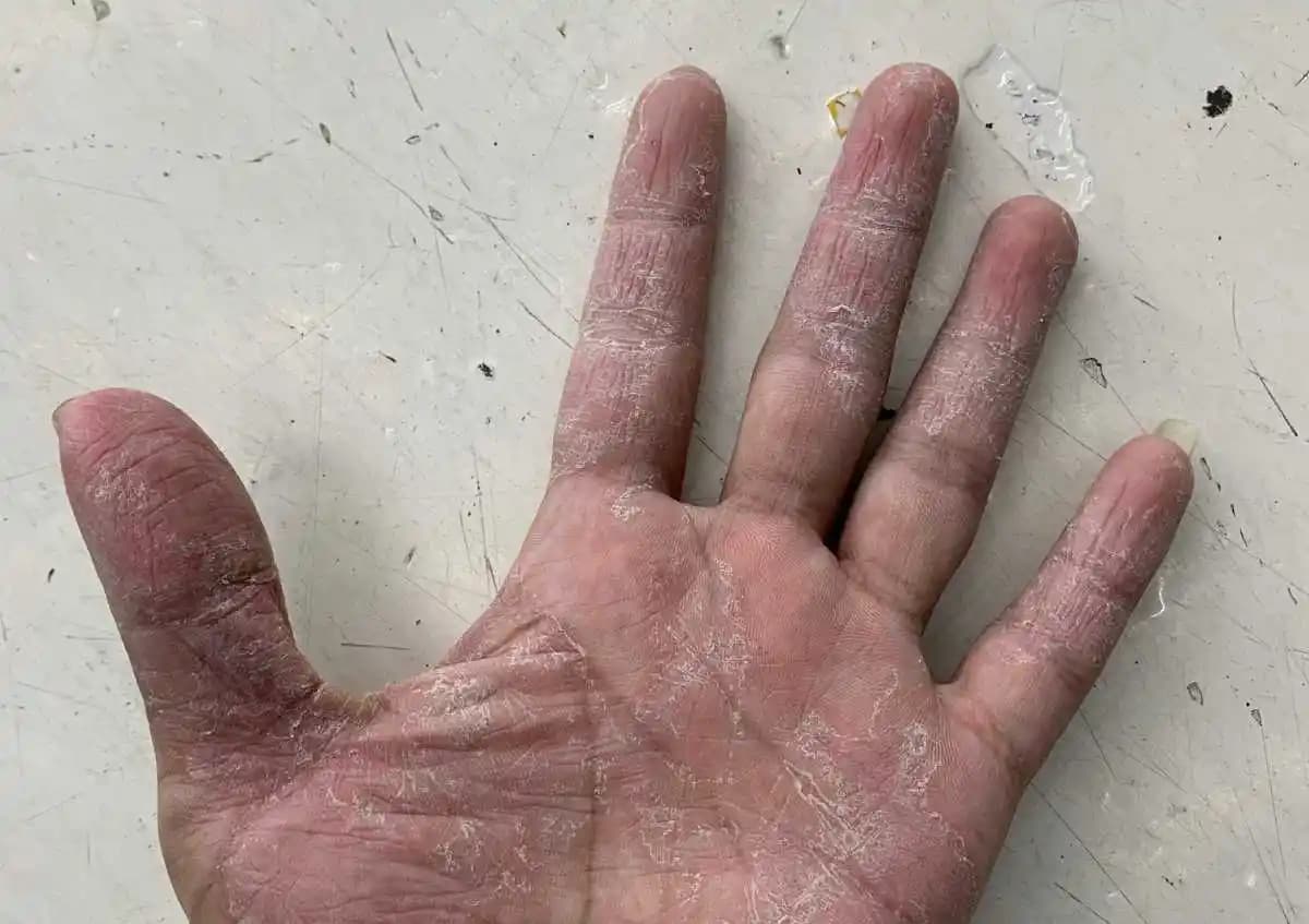 El Soyulmasının Kozmetik Sektöründeki Yeri ve Etkili Çözüm Yolları